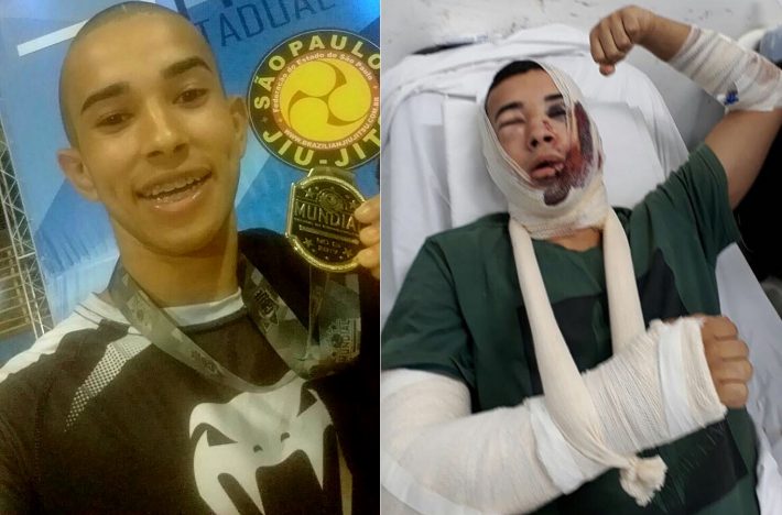 <strong>Guilherme Salomão fraturou a face e o punho em acidente de moto. Foto: Rosario Ruana Silva Gracia/Arquivo Pessoal</strong>