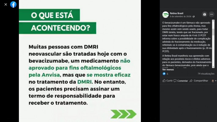 Screenshot of a Retina Brasil Facebook post.  Click on the image to access the full post.